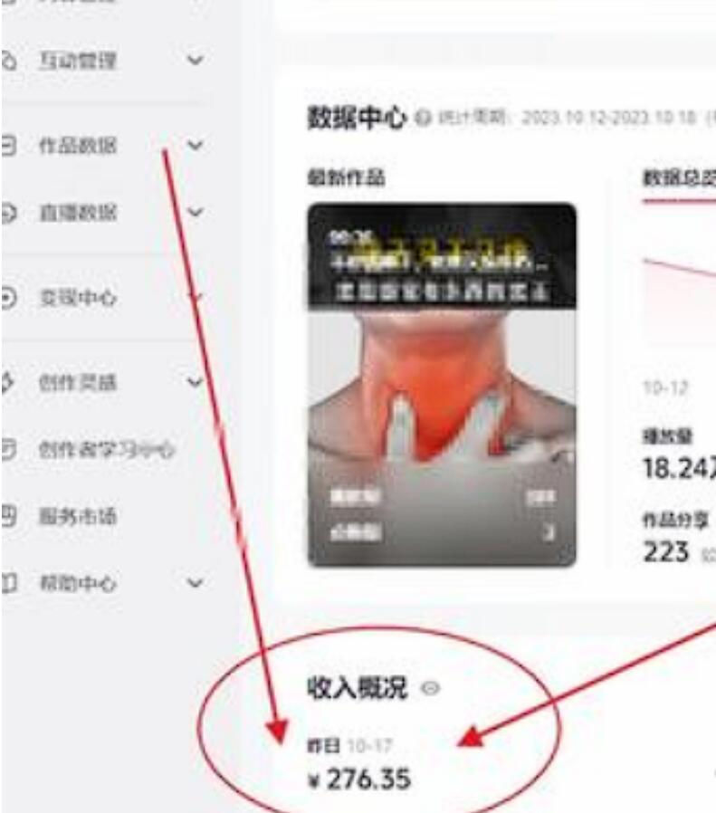 图片[2]-互联网风口项目：未来20年都不会过时的暴利项目-阿志说钱